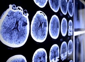 Brain Scan
