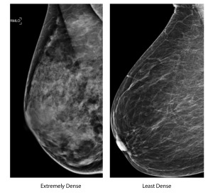 HealthBeat Breast Density