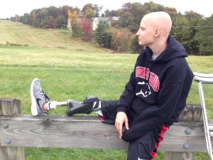 Austin Cohen New Leg