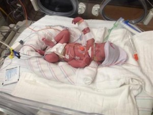Mother Dies Quadruplets