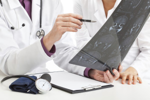 Brain health Thinkstock