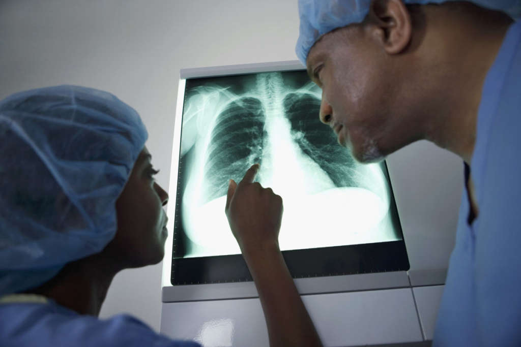 Two doctors having a discussion about an x ray of a human lung