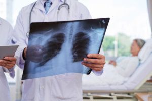 Examining chest x ray