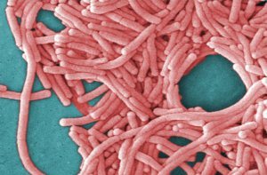 Legionnaires Disease Q and A
