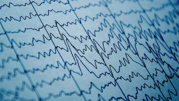 IStock BrainWaves
