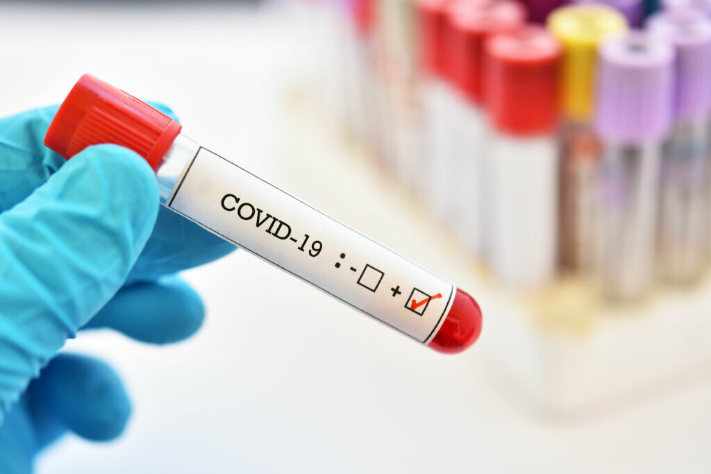 Blood sample tube positive with COVID