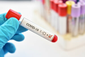 Blood sample tube positive with COVID