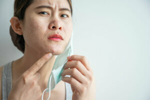 Asian woman worry about acne occur on her face after wearing mask for long time during covid 19 pandemic.