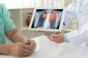 Lung cancer medical