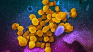 Virus Outbreak Inflammatory Condition Kids