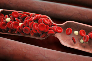 Blood clot