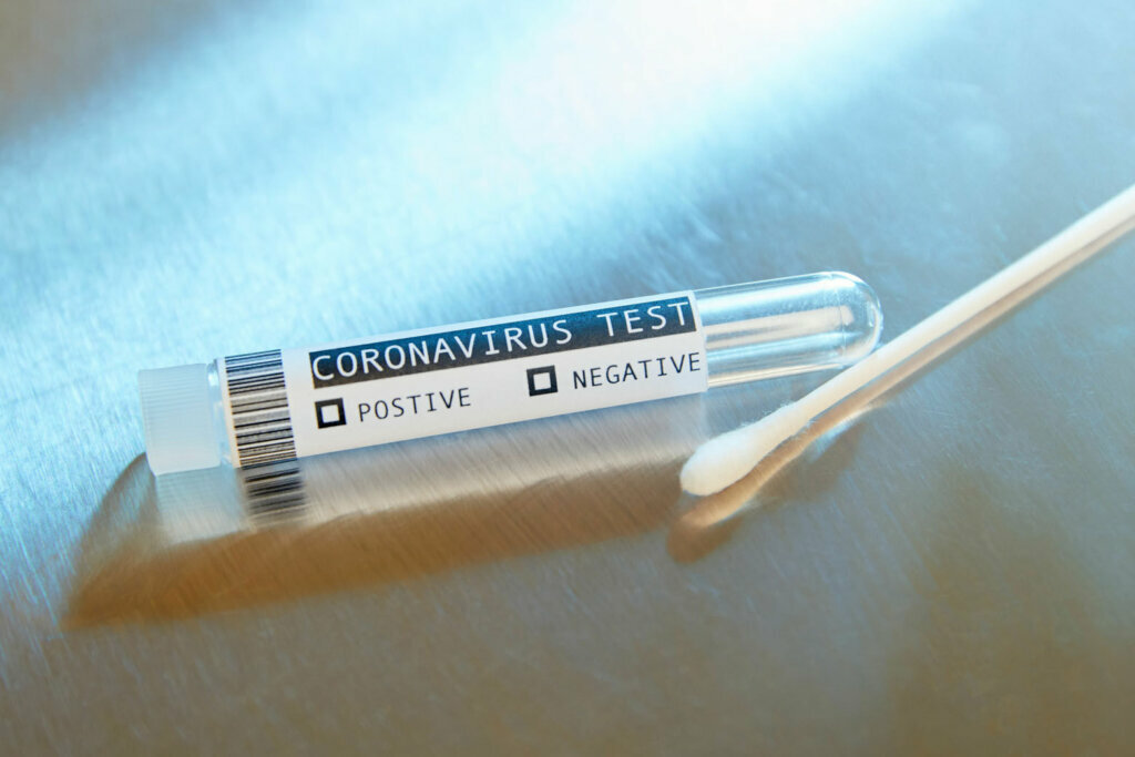 Blank Covid 19 Coronavirus test