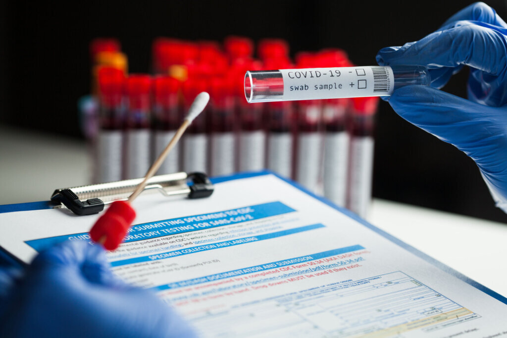 Coronavirus PCR test