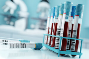 Blood Test Results In A Medical Lab