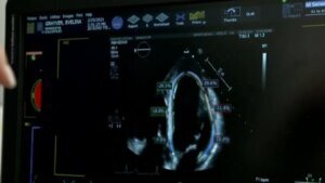 COVID may increase risk of developing heart issues