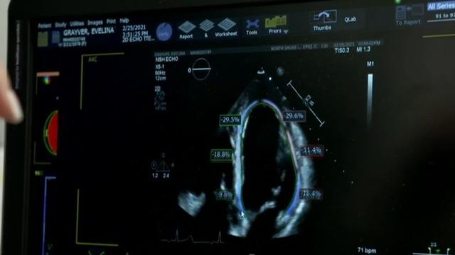 COVID may increase risk of developing heart issues
