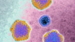 Hepatitis outbreak among children grows in U.S.
