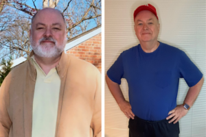 Nickbefore after