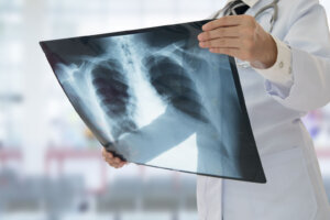 Doctor x ray
