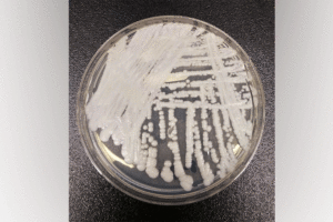 Superbug Fungus