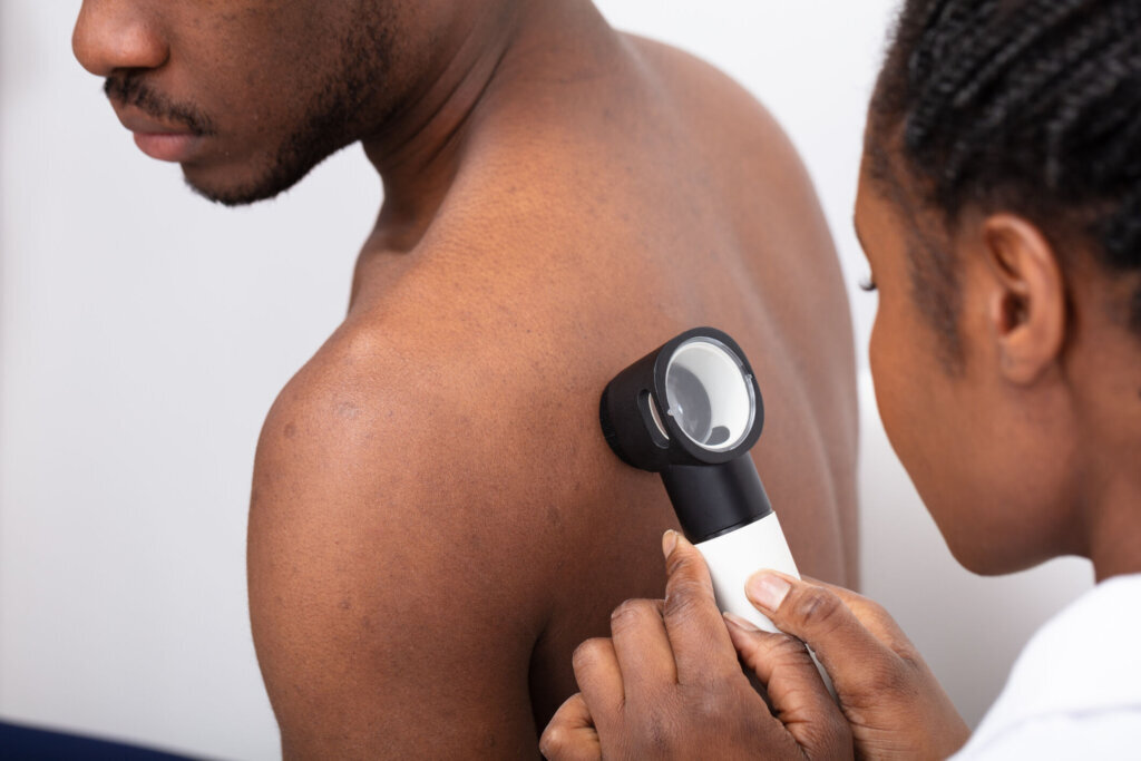 Close up Of A Doctor Checking Pigment Skin On Man's Back