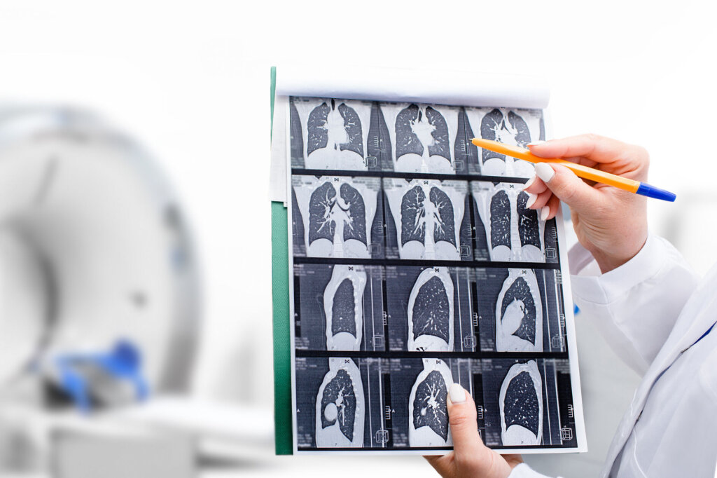 Radiologist showing tomography scan of a patient's lungs