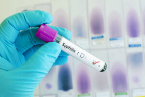 Syphilis positive