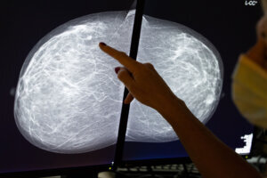 BRUSSELS SAINT JEAN BREAST CLINIC COVID