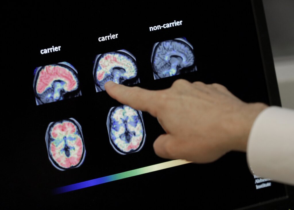 Be Well Shingles Vaccine Dementia