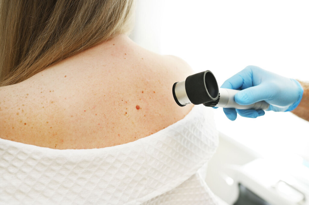 A dermatologist examines moles and skin growths on the patient's body using a special device a dermatoscope. Diagnosis and prevention of melanoma.