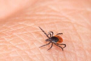 Tick bite