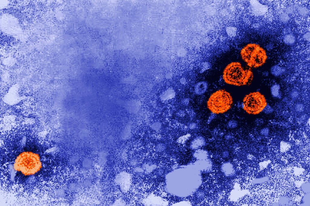 Guinea Bissau US Hepatitis B Study