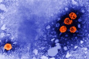 Guinea Bissau US Hepatitis B Study